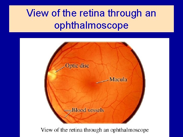 View of the retina through an ophthalmoscope 