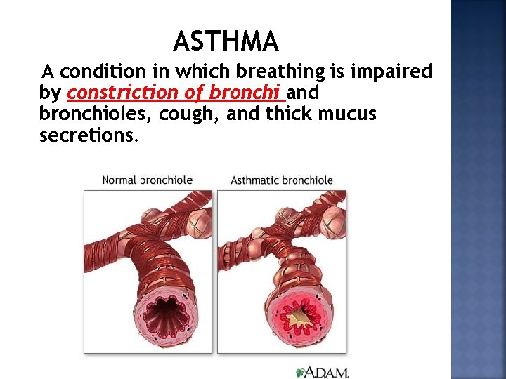 ASTHMA A condition in which breathing is impaired by constriction of bronchi and bronchioles,