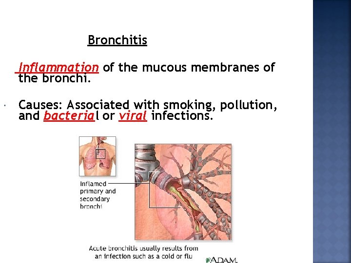 Bronchitis Inflammation of the mucous membranes of the bronchi. Causes: Associated with smoking, pollution,