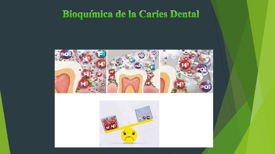 Bioquímica de la Caries Dental 