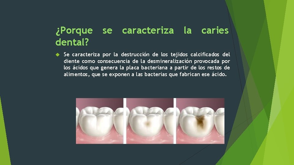 ¿Porque se caracteriza la caries dental? Se caracteriza por la destrucción de los tejidos