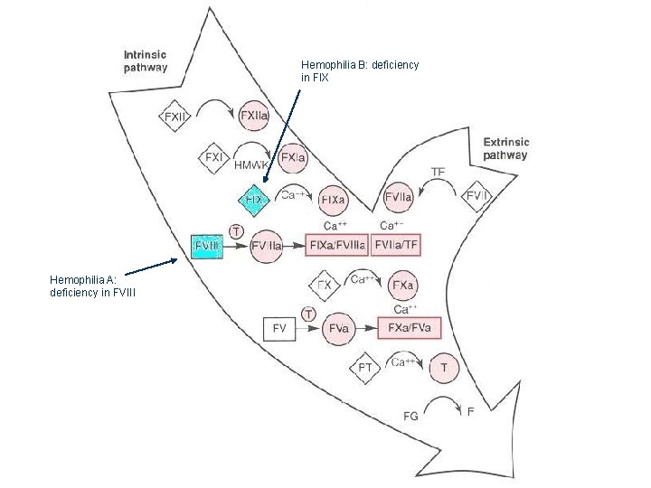 Hemophilia B: deficiency in FIX Hemophilia A: deficiency in FVIII 