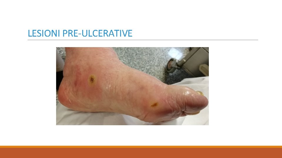 LESIONI PRE-ULCERATIVE 