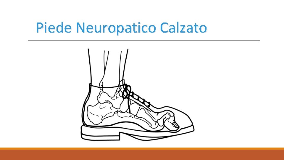 Piede Neuropatico Calzato 