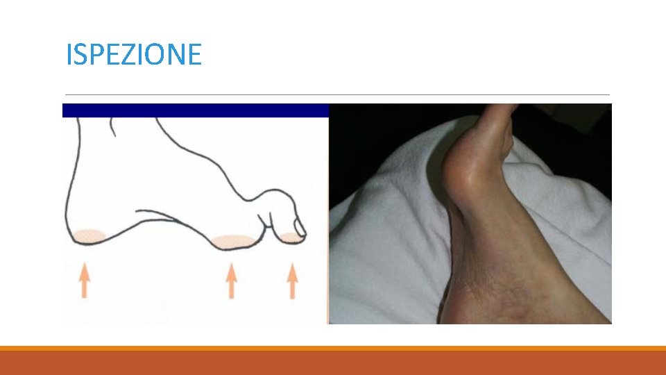 ISPEZIONE 