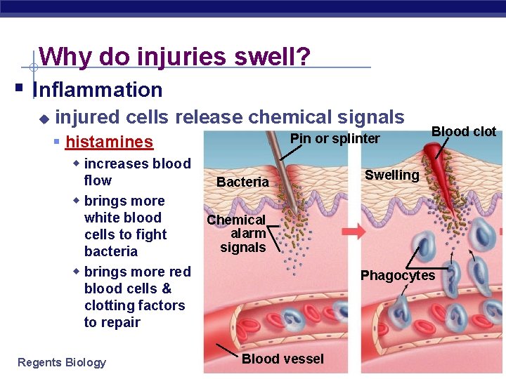 Why do injuries swell? § Inflammation u injured cells release chemical signals Pin or