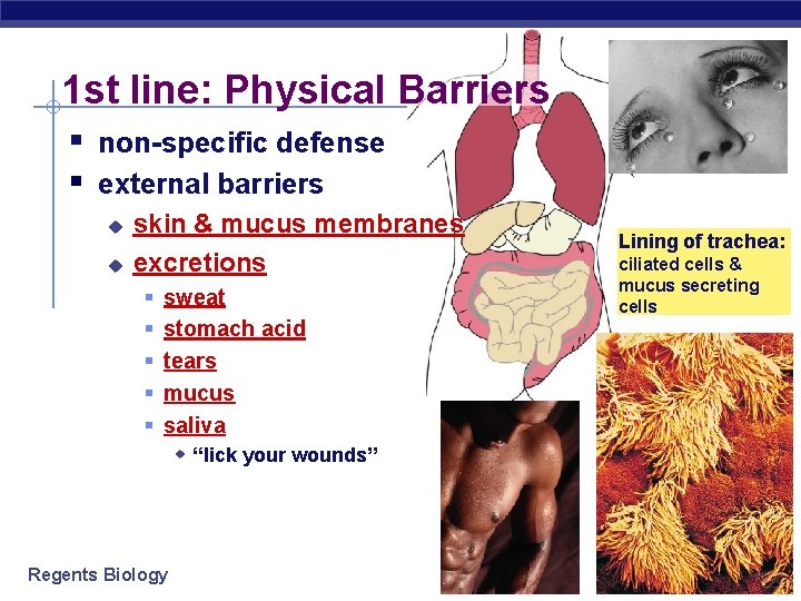 1 st line: Physical Barriers § non-specific defense § external barriers u u skin