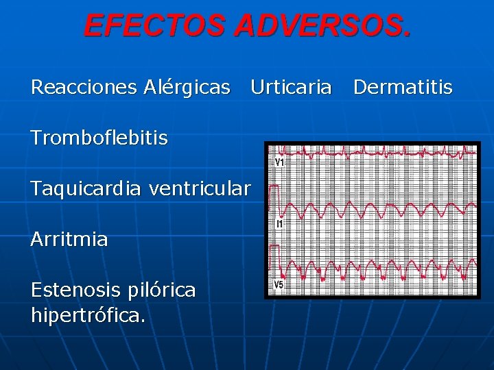 EFECTOS ADVERSOS. Reacciones Alérgicas Urticaria Tromboflebitis Taquicardia ventricular Arritmia Estenosis pilórica hipertrófica. Dermatitis 
