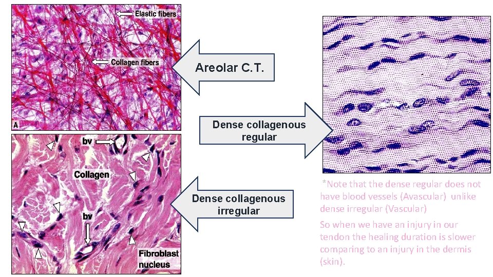 Areolar C. T. Dense collagenous regular Dense collagenous irregular *Note that the dense regular