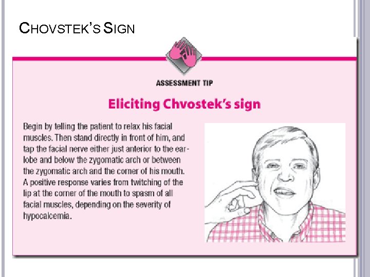 CHOVSTEK’S SIGN 