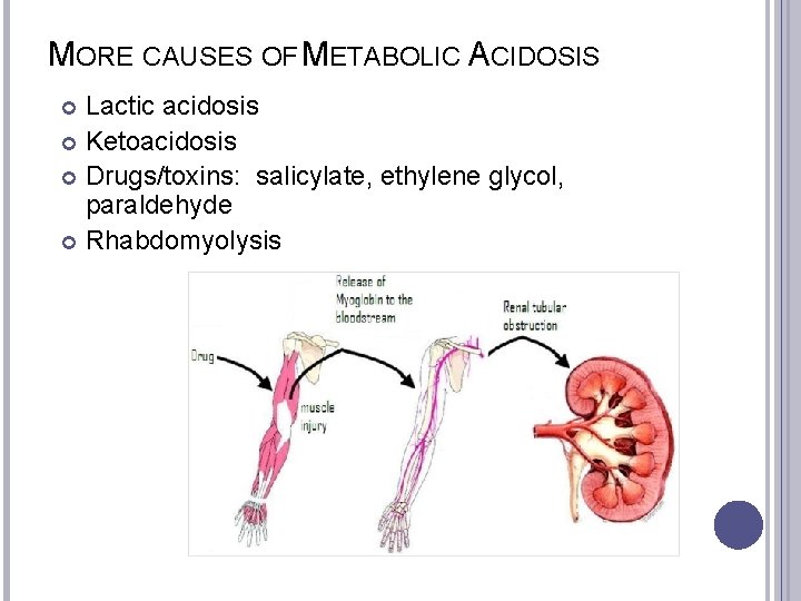 MORE CAUSES OF METABOLIC ACIDOSIS Lactic acidosis Ketoacidosis Drugs/toxins: salicylate, ethylene glycol, paraldehyde Rhabdomyolysis