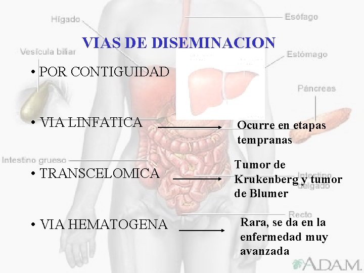 VIAS DE DISEMINACION • POR CONTIGUIDAD • VIA LINFATICA • TRANSCELOMICA • VIA HEMATOGENA