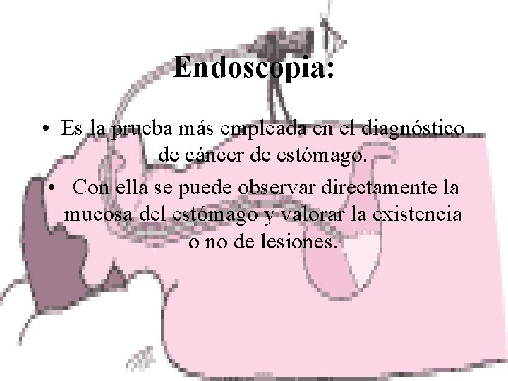 Endoscopia: • Es la prueba más empleada en el diagnóstico de cáncer de estómago.