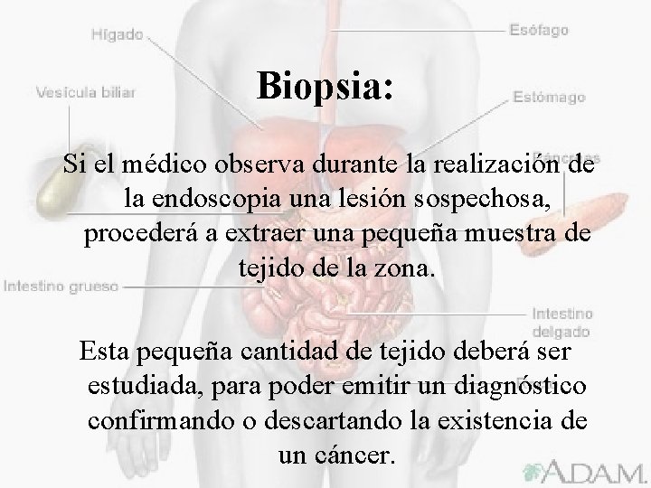 Biopsia: Si el médico observa durante la realización de la endoscopia una lesión sospechosa,