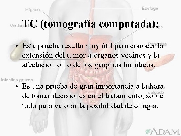 TC (tomografía computada): • Esta prueba resulta muy útil para conocer la extensión del