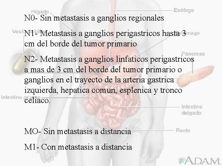 N 0 - Sin metastasis a ganglios regionales N 1 - Metastasis a ganglios