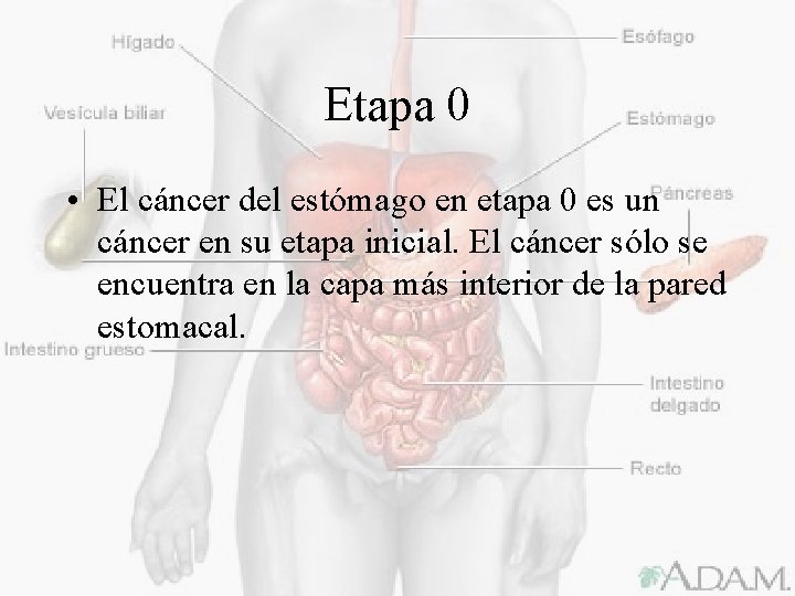 Etapa 0 • El cáncer del estómago en etapa 0 es un cáncer en