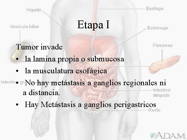 Etapa I Tumor invade • la lamina propia o submucosa • la musculatura esofágica
