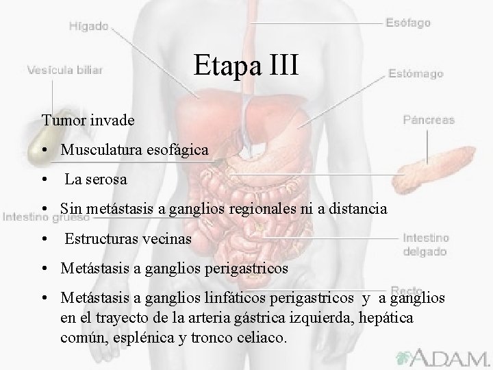 Etapa III Tumor invade • Musculatura esofágica • La serosa • Sin metástasis a