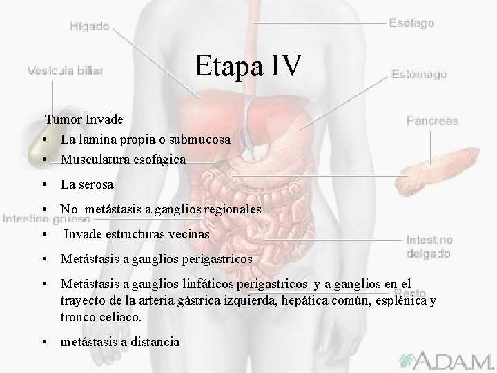 Etapa IV Tumor Invade • La lamina propia o submucosa • Musculatura esofágica •