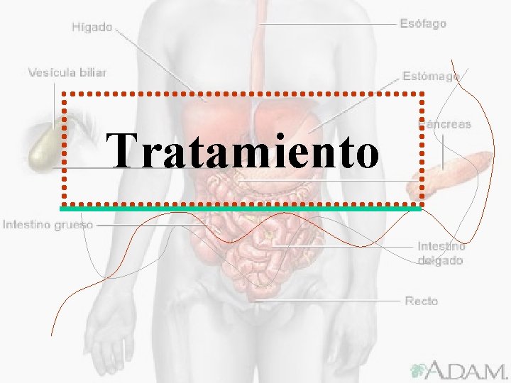 Tratamiento 