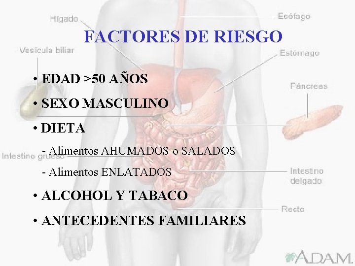 FACTORES DE RIESGO • EDAD >50 AÑOS • SEXO MASCULINO • DIETA - Alimentos