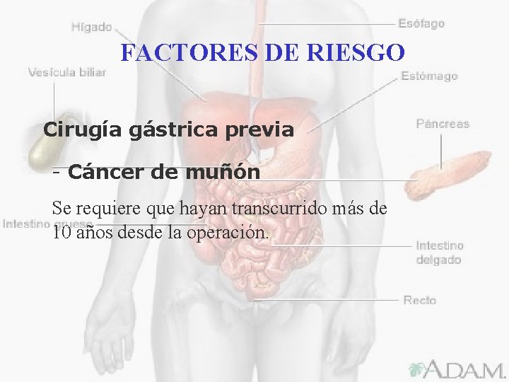 FACTORES DE RIESGO Cirugía gástrica previa - Cáncer de muñón Se requiere que hayan