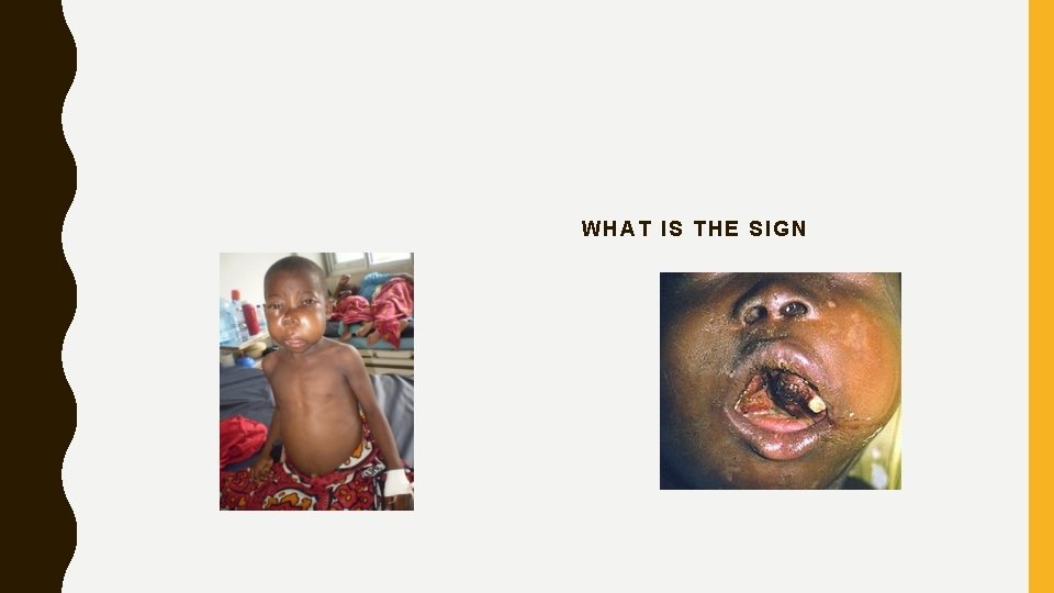 WHAT IS THE SIGN 