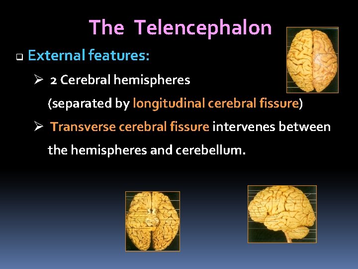 The Telencephalon q External features: Ø 2 Cerebral hemispheres (separated by longitudinal cerebral fissure)