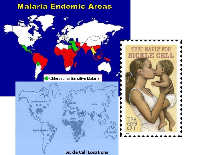 Sickle Cell Locations 