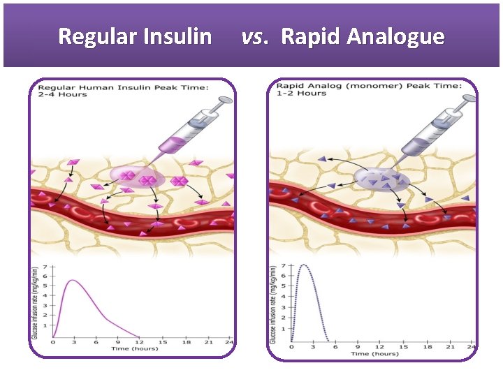 Regular Insulin vs. Rapid Analogue 