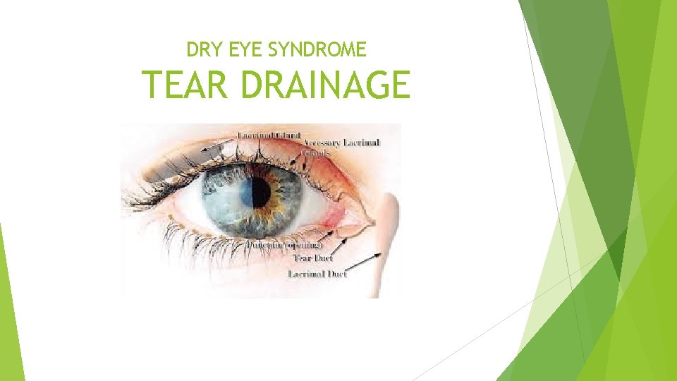 DRY EYE SYNDROME TEAR DRAINAGE 