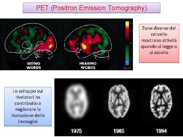 PET (Positron Emission Tomography) Zone diverse del cervello mostrano attività quando si legge o