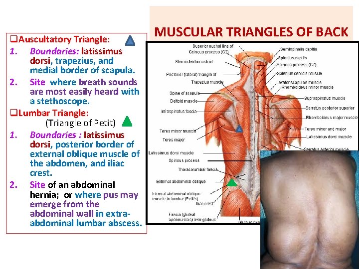 q. Auscultatory Triangle: 1. Boundaries: latissimus dorsi, trapezius, and medial border of scapula. 2.