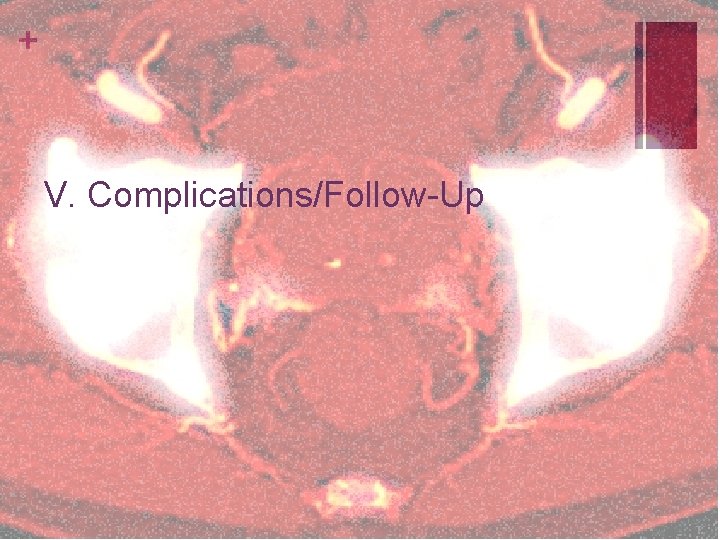 + V. Complications/Follow-Up 