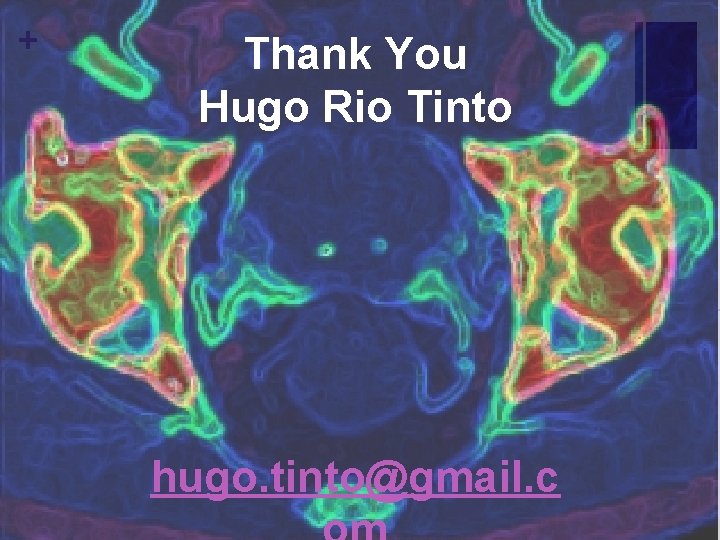 + Thank You Hugo Rio Tinto hugo. tinto@gmail. c 