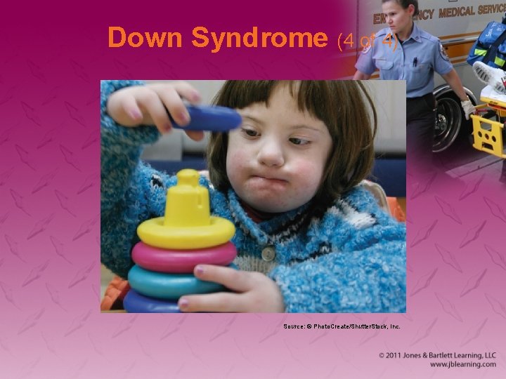Down Syndrome (4 of 4) Source: © Photo. Create/Shutter. Stock, Inc. 