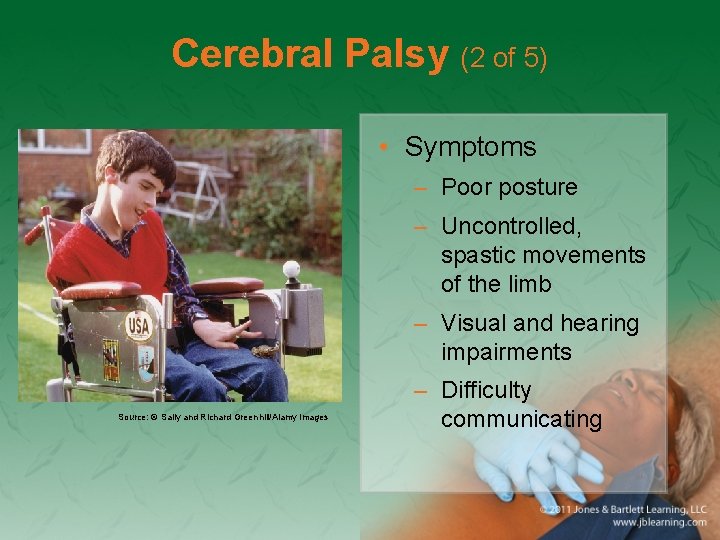 Cerebral Palsy (2 of 5) • Symptoms – Poor posture – Uncontrolled, spastic movements