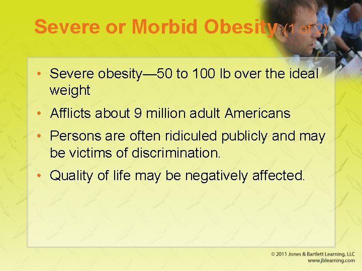 Severe or Morbid Obesity (1 of 2) • Severe obesity— 50 to 100 lb