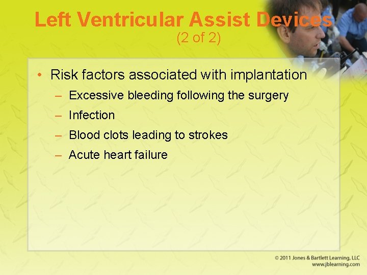 Left Ventricular Assist Devices (2 of 2) • Risk factors associated with implantation –