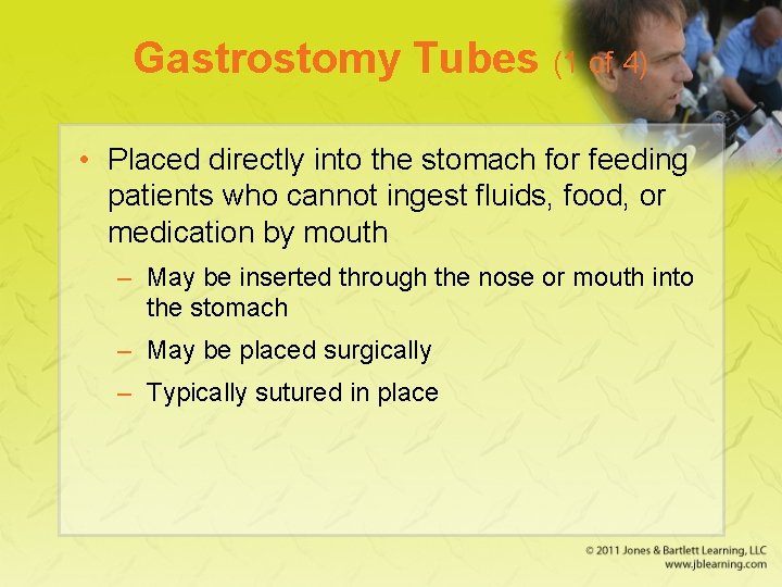 Gastrostomy Tubes (1 of 4) • Placed directly into the stomach for feeding patients