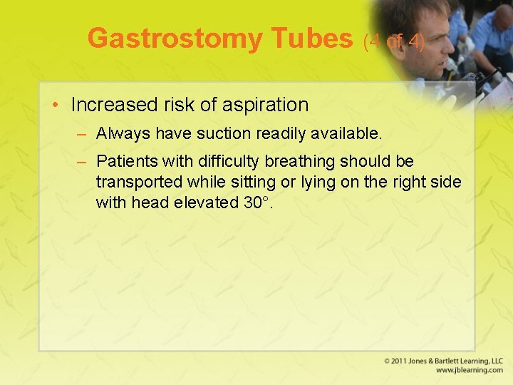 Gastrostomy Tubes (4 of 4) • Increased risk of aspiration – Always have suction