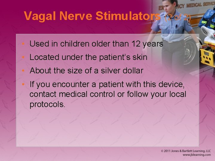 Vagal Nerve Stimulators (2 of 2) • Used in children older than 12 years