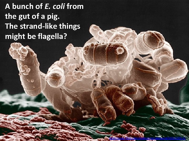 A bunch of E. coli from the gut of a pig. The strand-like things