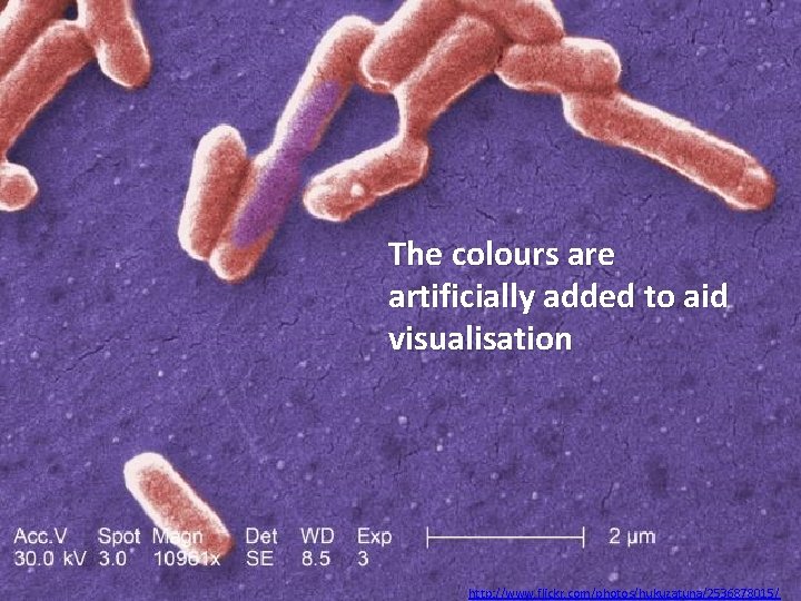 The colours are artificially added to aid visualisation http: //www. flickr. com/photos/hukuzatuna/2536878015/ 