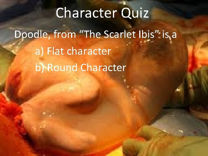 Character Quiz Doodle, from “The Scarlet Ibis” is a a) Flat character b) Round