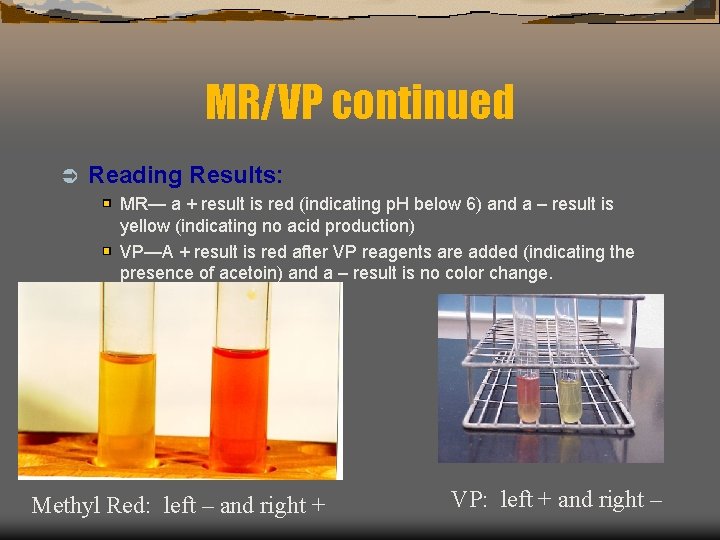 MR/VP continued Ü Reading Results: MR— a + result is red (indicating p. H