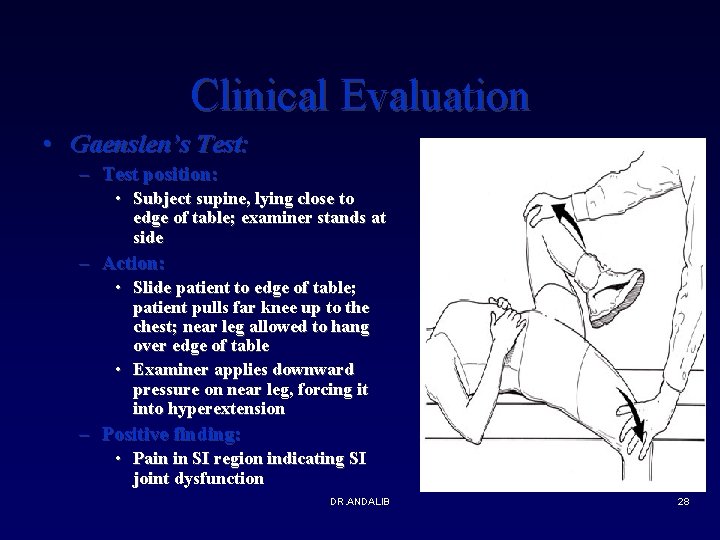 Clinical Evaluation • Gaenslen’s Test: – Test position: • Subject supine, lying close to