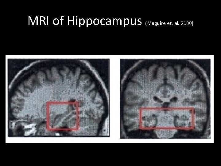 MRI of Hippocampus (Maguire et. al. 2000) 