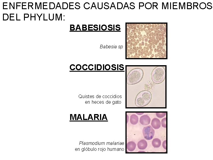 ENFERMEDADES CAUSADAS POR MIEMBROS DEL PHYLUM: BABESIOSIS Babesia sp COCCIDIOSIS Quistes de coccidios en